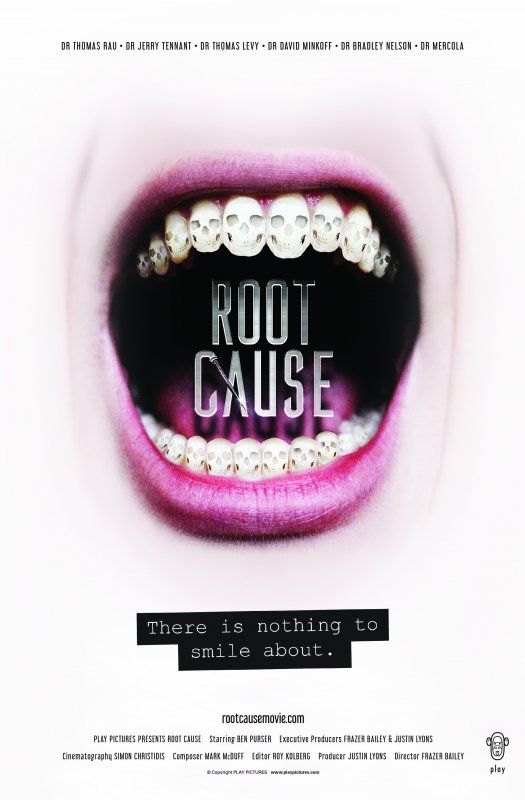 Affiche du film Root Cause (2019) de Frazer Bailey Affiche du film Root Cause (2019) de Frazer Bailey. Voir Root Cause en streaming / torrent sur meilleurs-films.fr